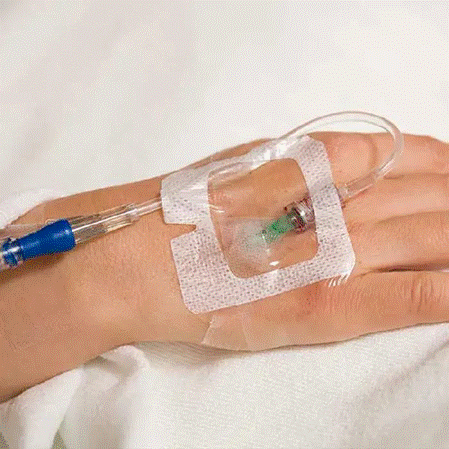 IV in the hands of older people may cause significant brusing, which is compounded if the IV therapy is frequent and they are aspirin or other anticoagulant