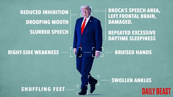 What Is Medically Wrong With Donald&nbsp;Trump?