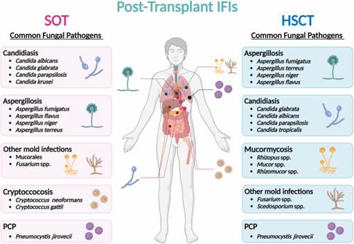 Fungal Pathogens in Sepsis